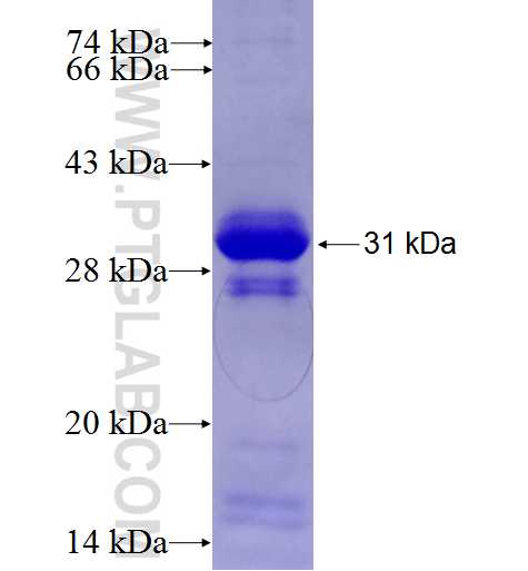 BAP1 fusion protein Ag27333 SDS-PAGE