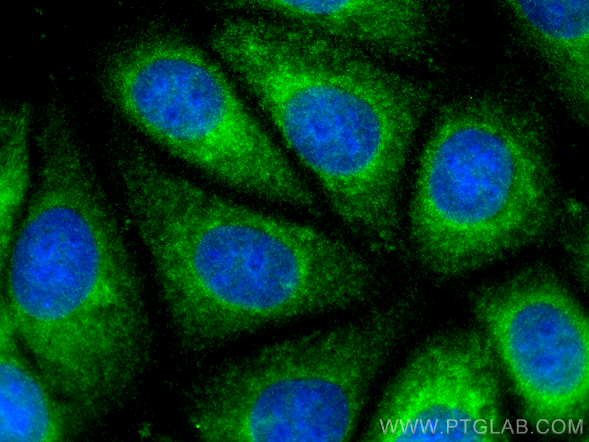 Immunofluorescence (IF) / fluorescent staining of MCF-7 cells using BAX Polyclonal antibody (50599-2-Ig)