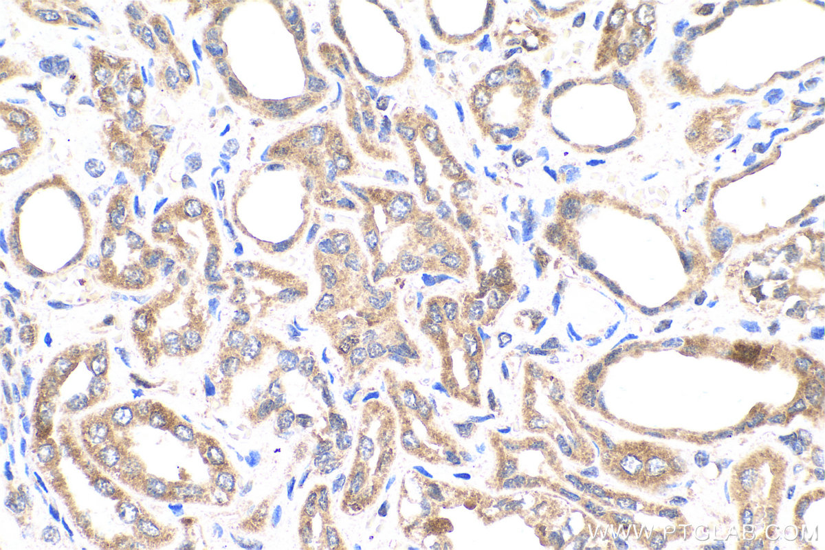 Immunohistochemistry (IHC) staining of human kidney tissue using BAX Monoclonal antibody (60267-1-Ig)