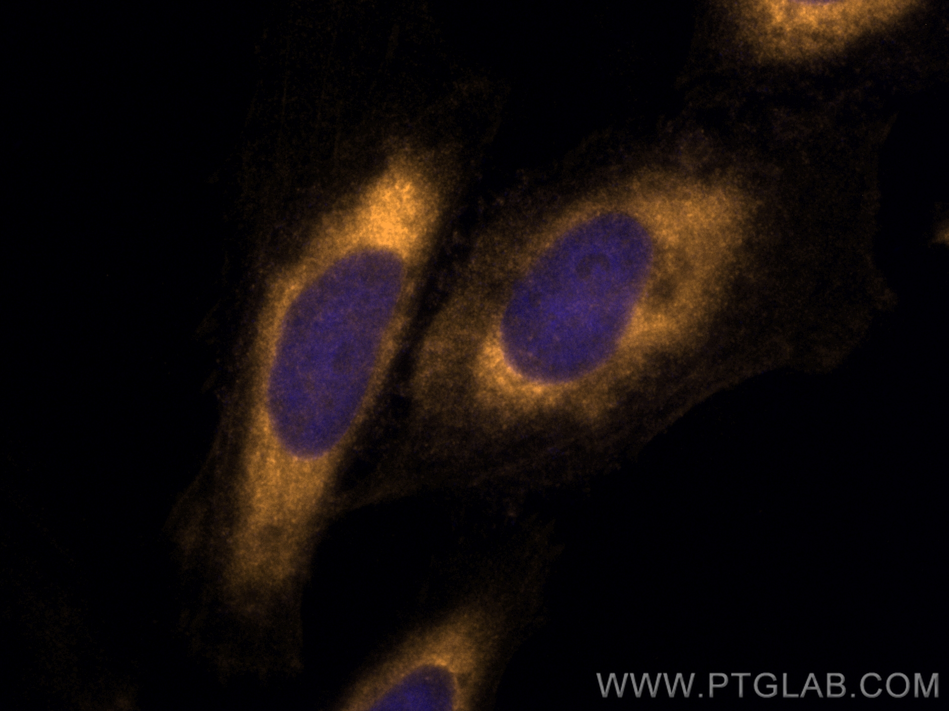 Immunofluorescence (IF) / fluorescent staining of HeLa cells using CoraLite®555-conjugated BAX Monoclonal antibody (CL555-60267)