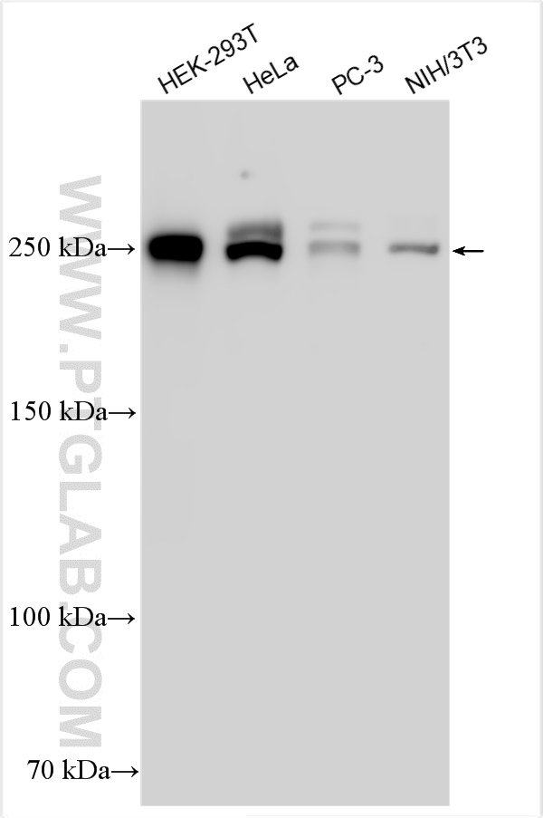 Western Blot (WB) analysis of various lysates using BAZ2A Polyclonal antibody (30984-1-AP)