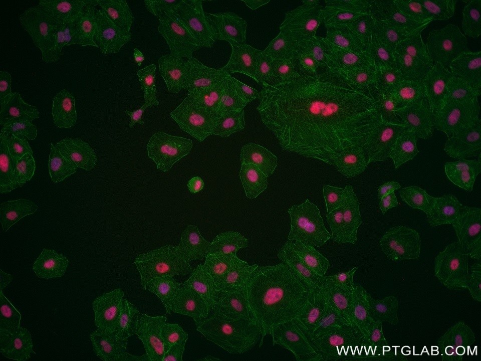 Immunofluorescence (IF) / fluorescent staining of A549 cells using BAZ2A Recombinant antibody (82910-1-RR)