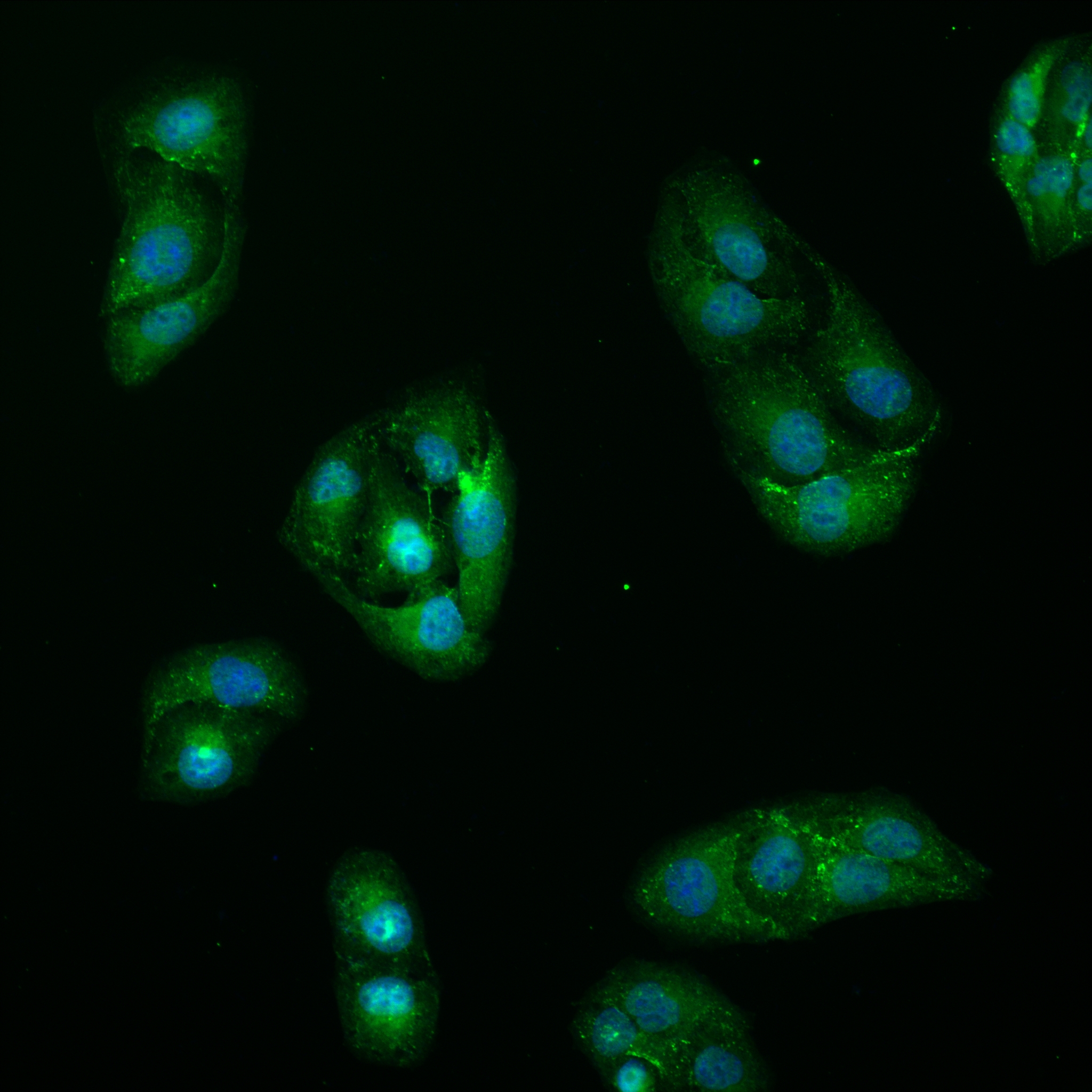 Immunofluorescence (IF) / fluorescent staining of U2OS cells using BAZ2A Recombinant antibody (82910-2-RR)