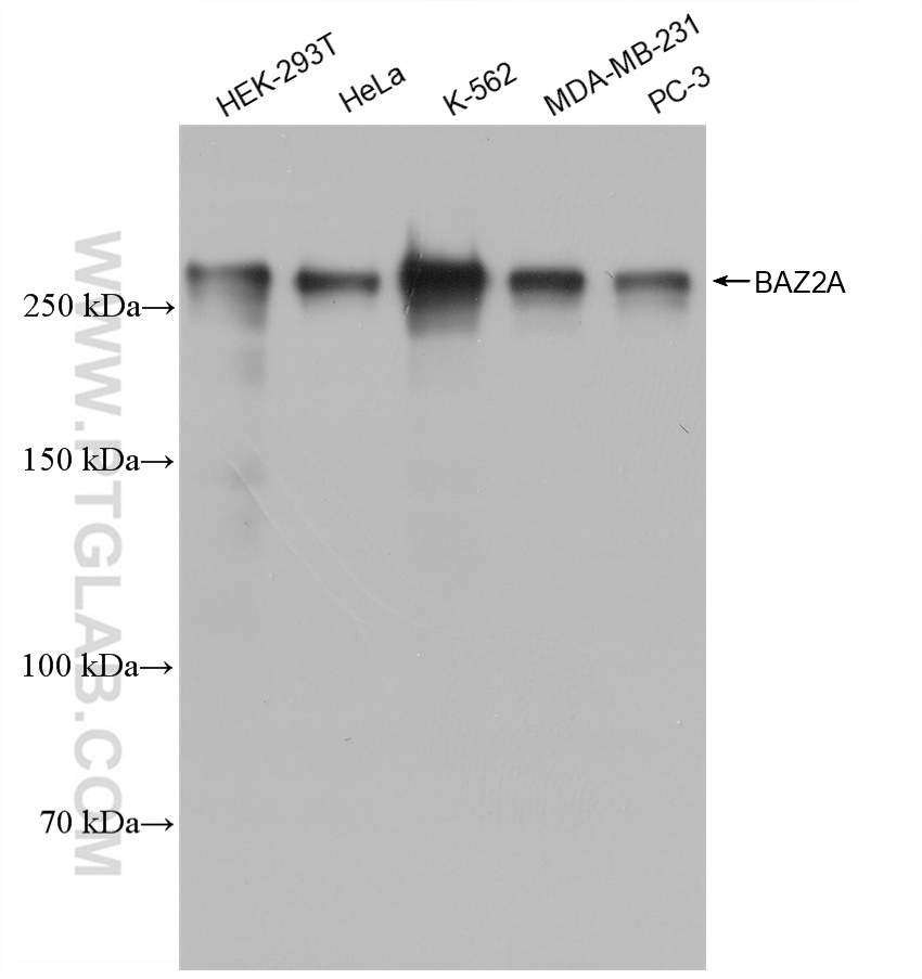 Western Blot (WB) analysis of various lysates using BAZ2A Recombinant antibody (82910-2-RR)