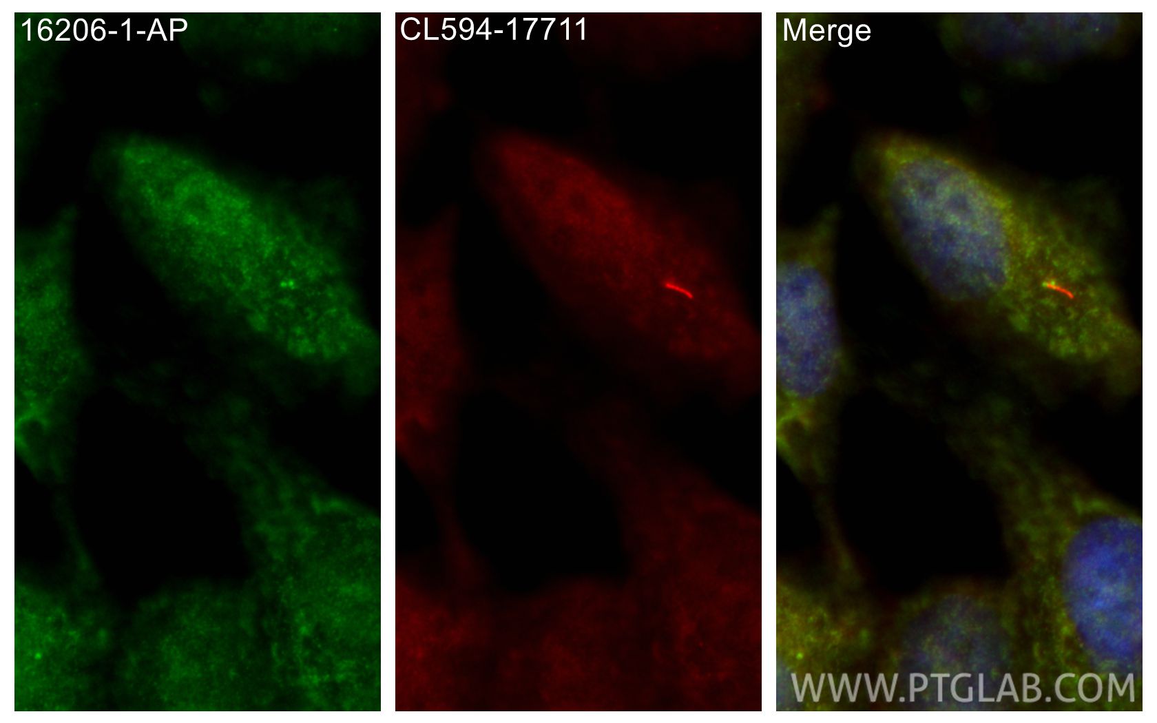 Immunofluorescence (IF) / fluorescent staining of hTERT-RPE1 cells using MKS1 Polyclonal antibody (16206-1-AP)