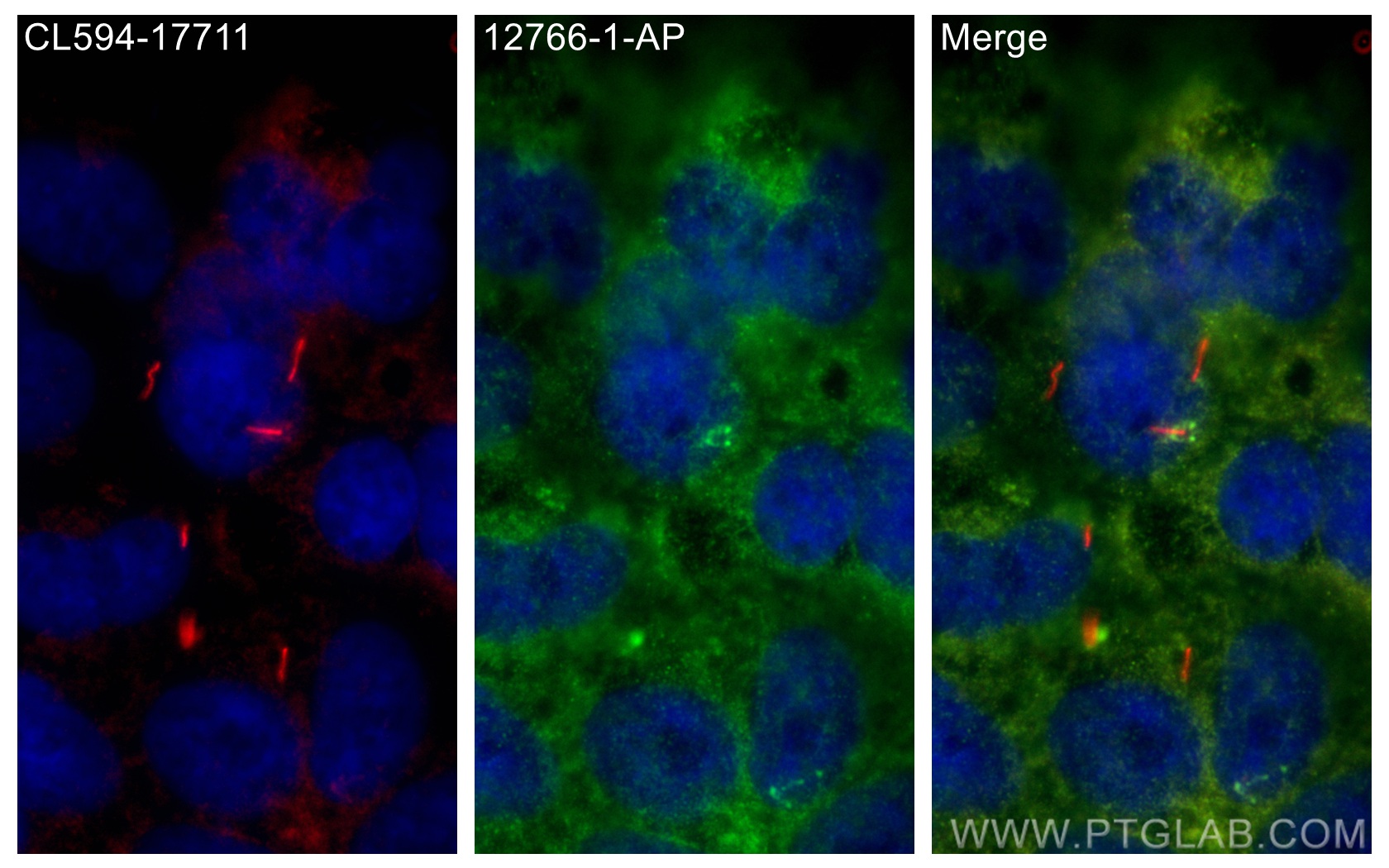 Immunofluorescence (IF) / fluorescent staining of hTERT-RPE1 cells using BBS4 Polyclonal antibody (12766-1-AP)