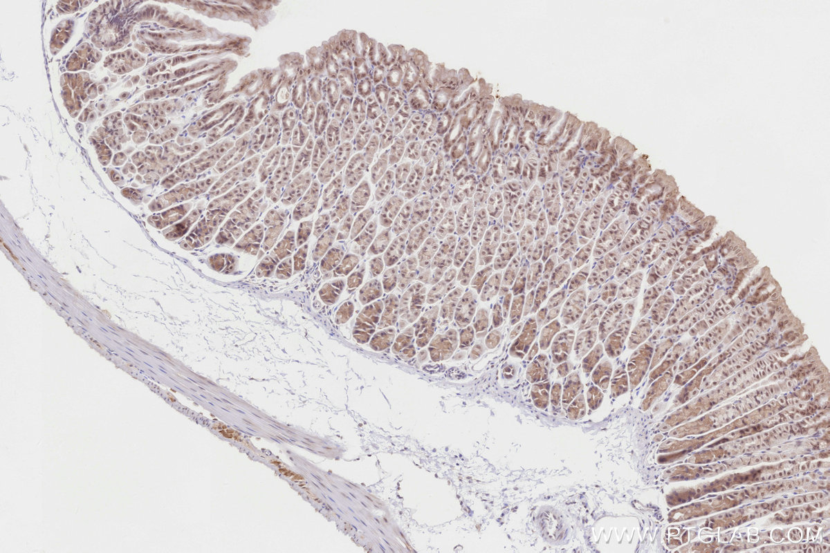 Immunohistochemistry (IHC) staining of mouse stomach tissue using BBS4 Polyclonal antibody (12766-1-AP)