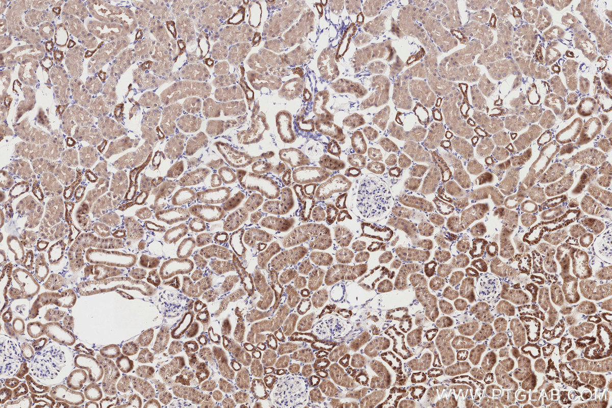Immunohistochemistry (IHC) staining of rat kidney tissue using BBS4 Polyclonal antibody (12766-1-AP)