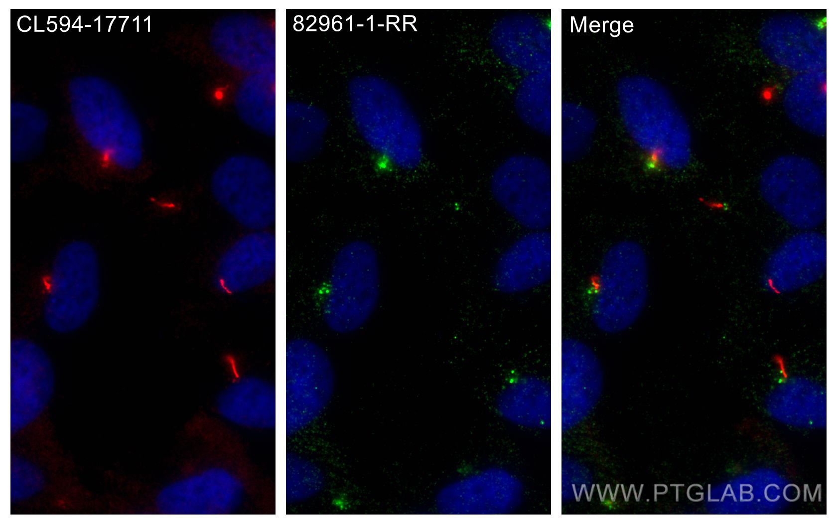 Immunofluorescence (IF) / fluorescent staining of hTERT-RPE1 cells using BBS4 Recombinant antibody (82961-1-RR)