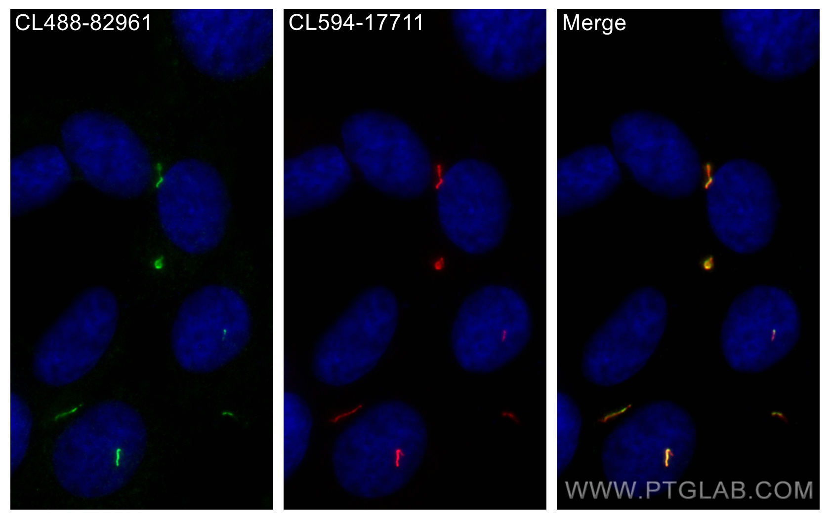 Immunofluorescence (IF) / fluorescent staining of hTERT-RPE1 cells using CoraLite® Plus 488-conjugated BBS4 Recombinant ant (CL488-82961)