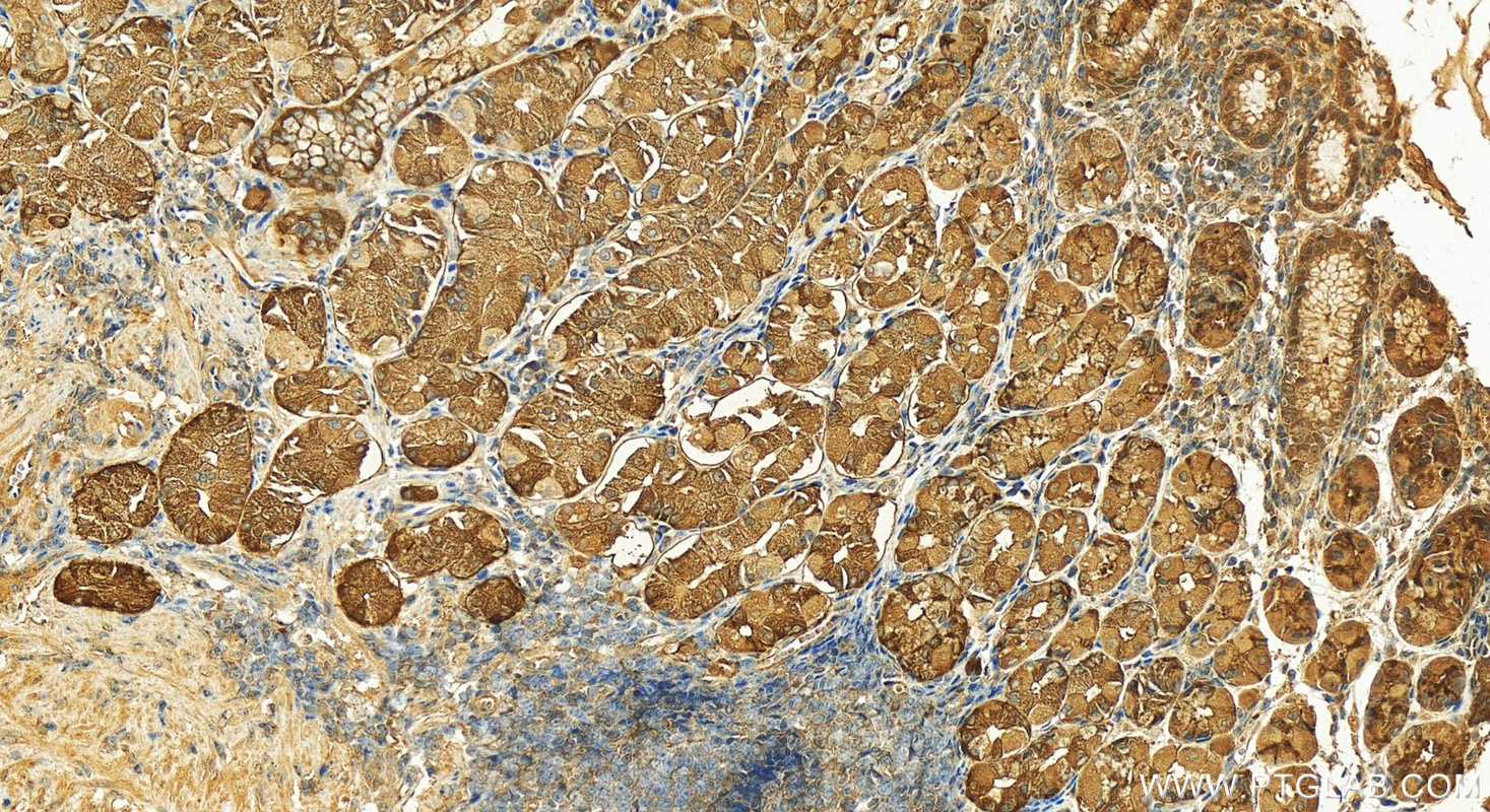 Immunohistochemistry (IHC) staining of human stomach tissue using BBS5 Polyclonal antibody (14569-1-AP)