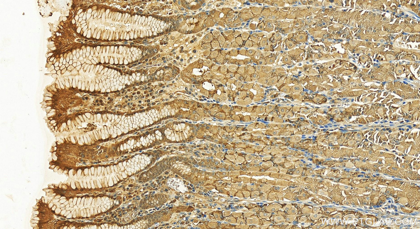 Immunohistochemistry (IHC) staining of human stomach tissue using BBS5 Polyclonal antibody (14569-1-AP)