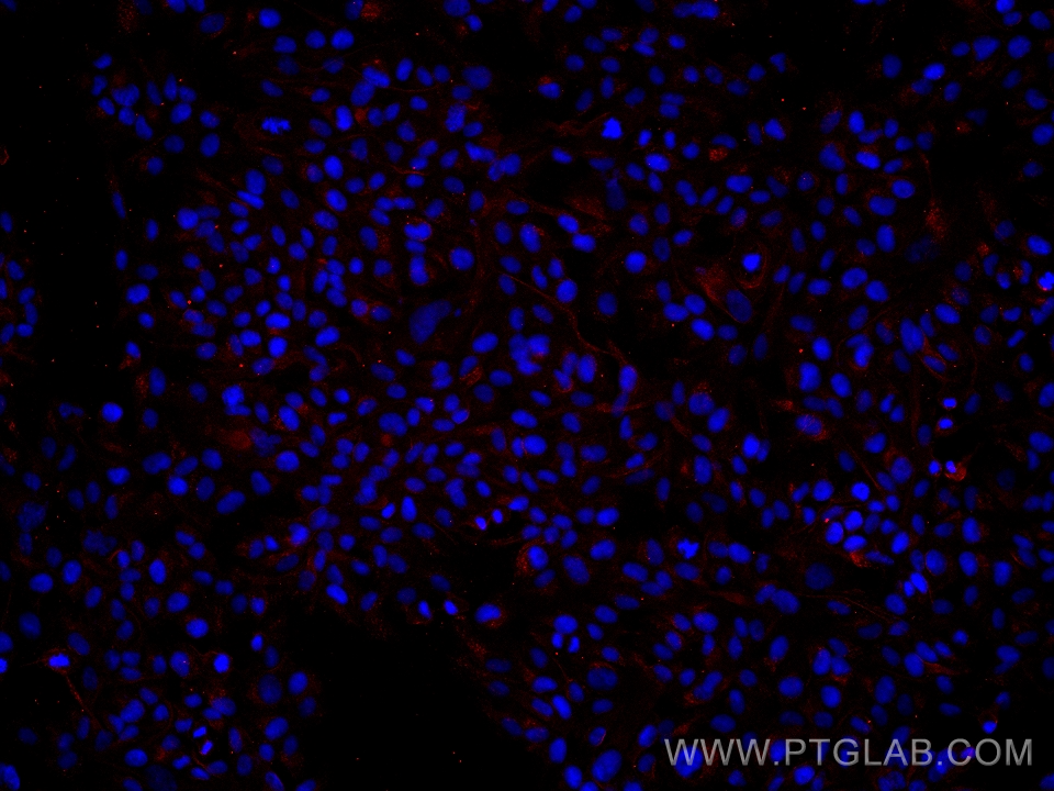 Immunofluorescence (IF) / fluorescent staining of hTERT-RPE1 cells using BBS5 Monoclonal antibody (66136-1-Ig)