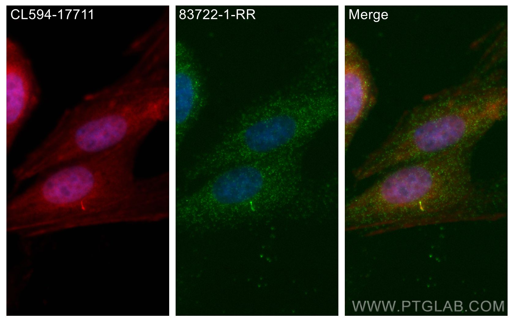 Immunofluorescence (IF) / fluorescent staining of MDCK cells using BBS5 Recombinant antibody (83722-1-RR)