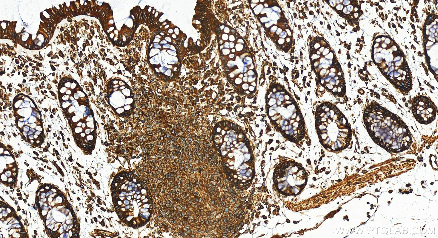 Immunohistochemistry (IHC) staining of human colon tissue using BAP31 Polyclonal antibody (11200-1-AP)