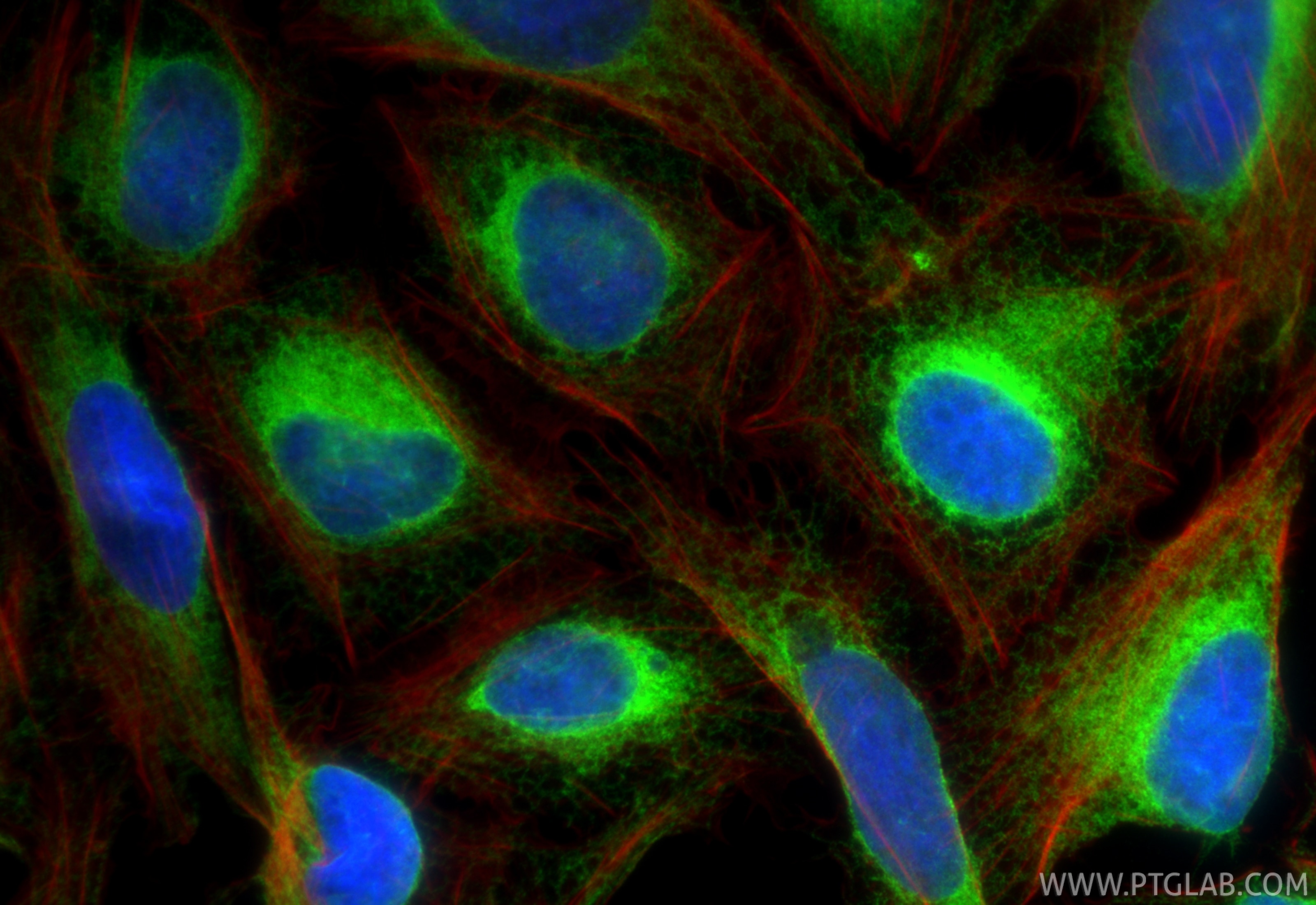 Immunofluorescence (IF) / fluorescent staining of U2OS cells using BAP31 Polyclonal antibody (11200-1-AP)
