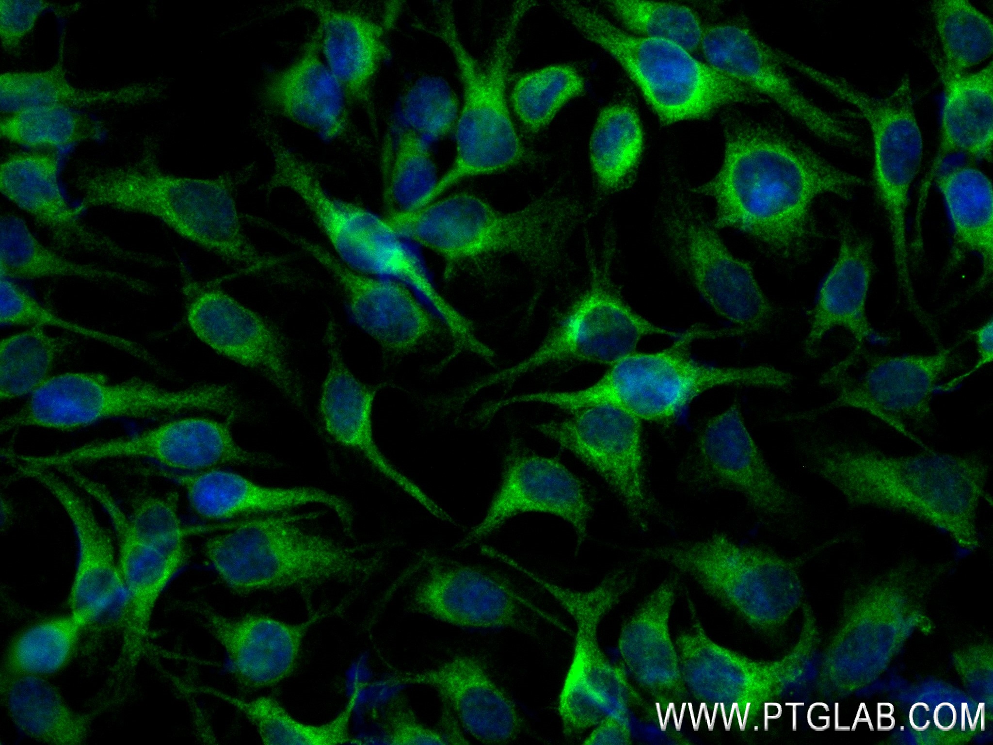 Immunofluorescence (IF) / fluorescent staining of HeLa cells using BAP31 Recombinant antibody (84584-5-RR)