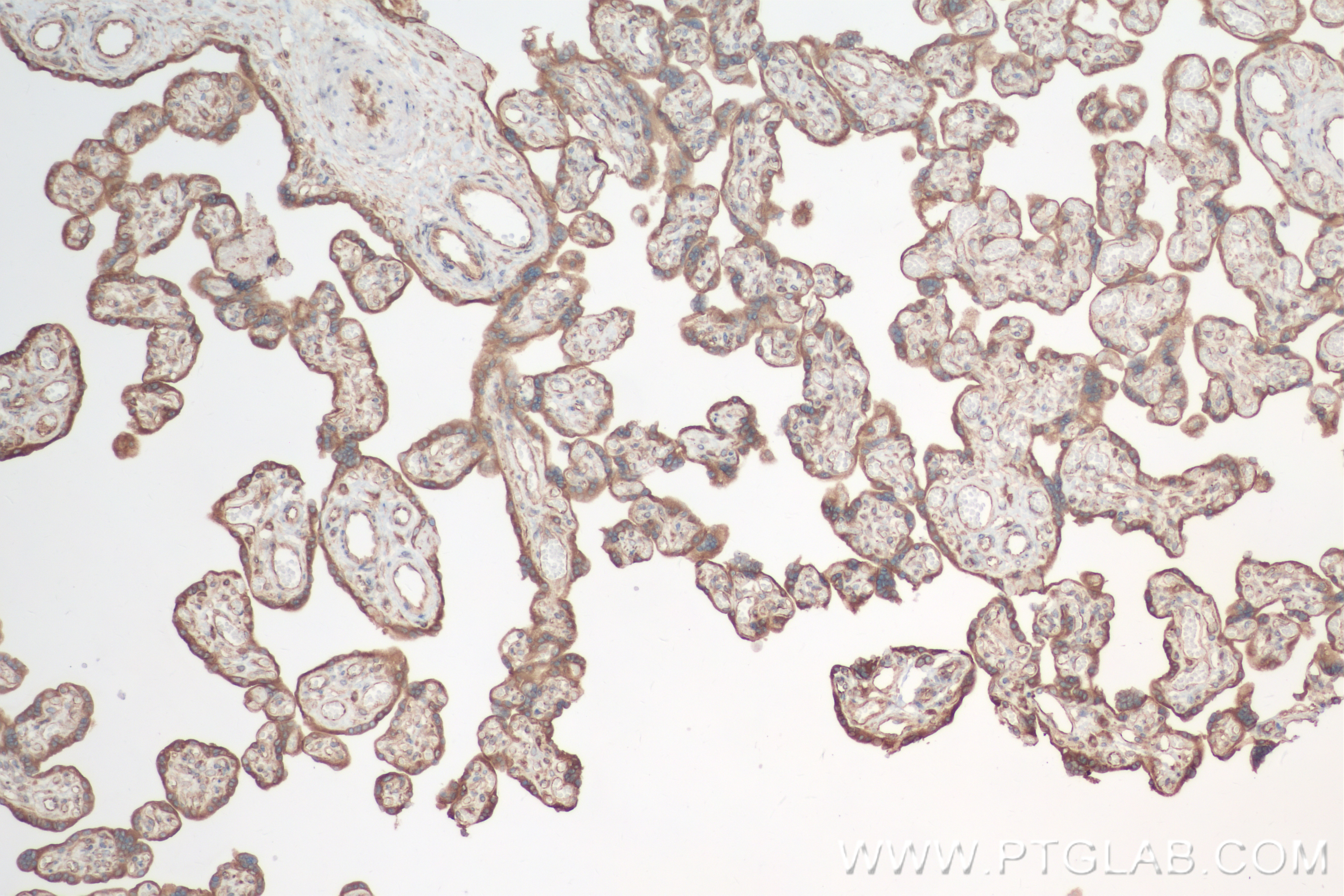 Immunohistochemistry (IHC) staining of human placenta tissue using BAP31 Recombinant antibody (84584-5-RR)