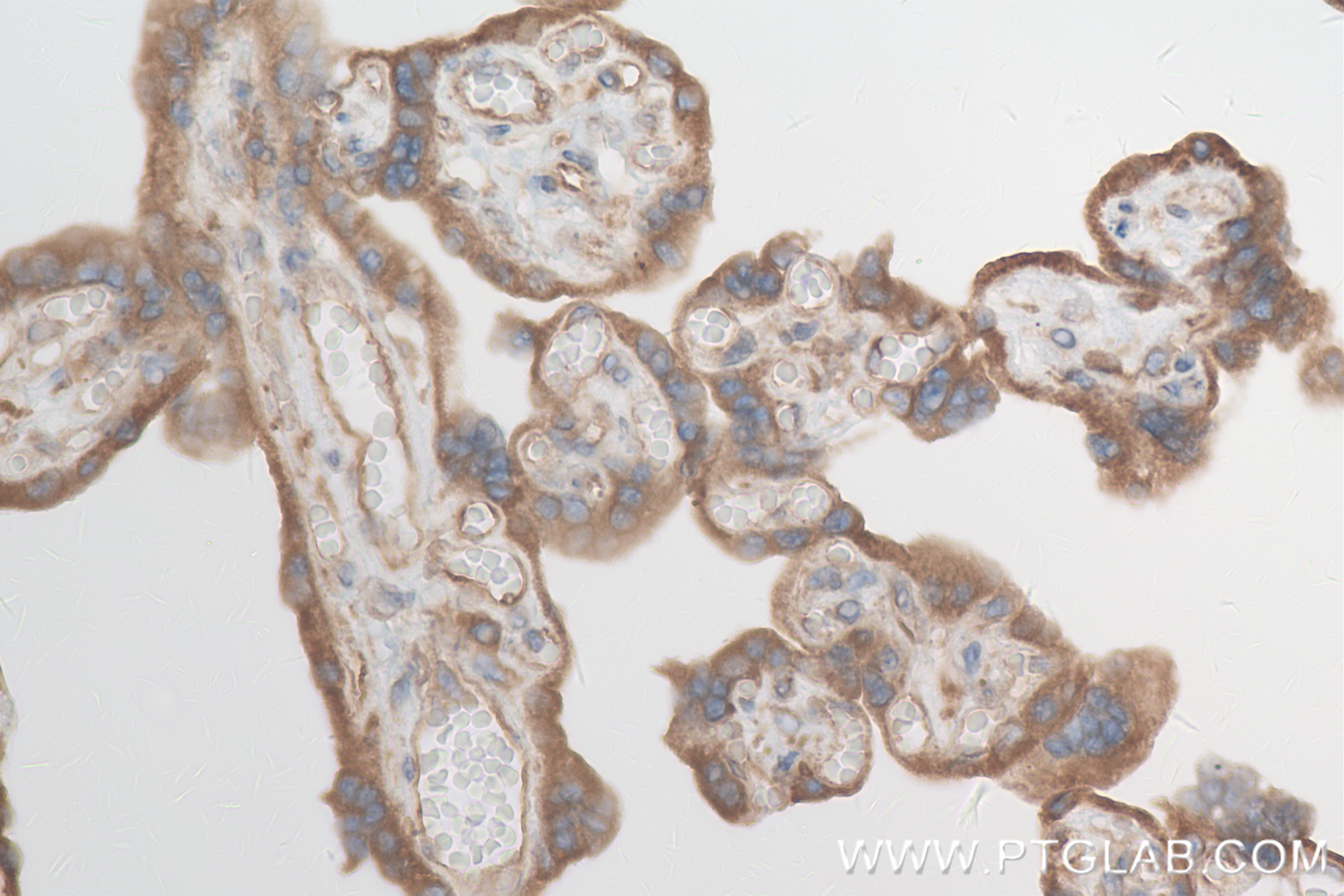 Immunohistochemistry (IHC) staining of human placenta tissue using BAP31 Recombinant antibody (84584-5-RR)