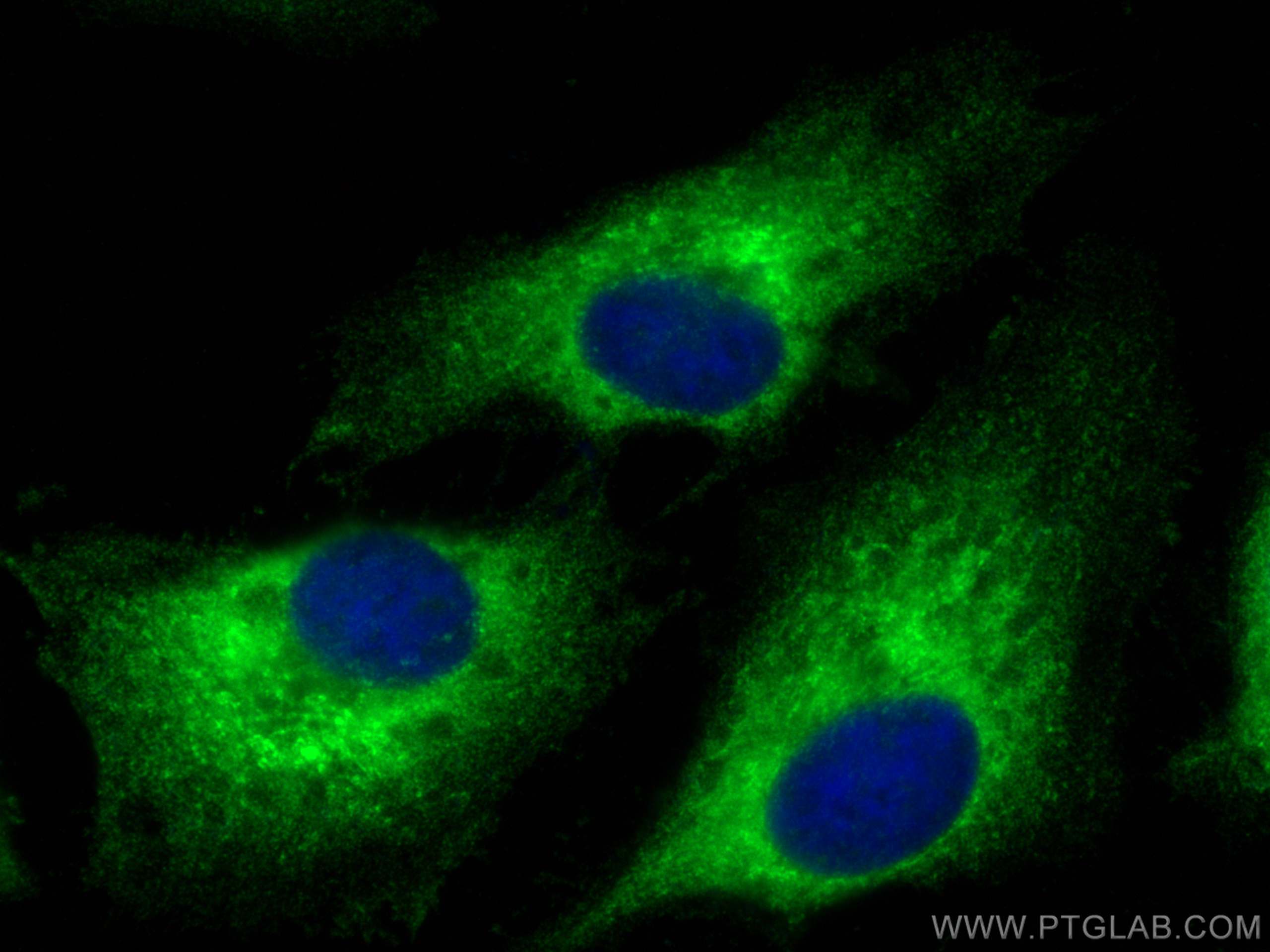 Immunofluorescence (IF) / fluorescent staining of HeLa cells using p130Cas / BCAR1 Polyclonal antibody (16815-1-AP)