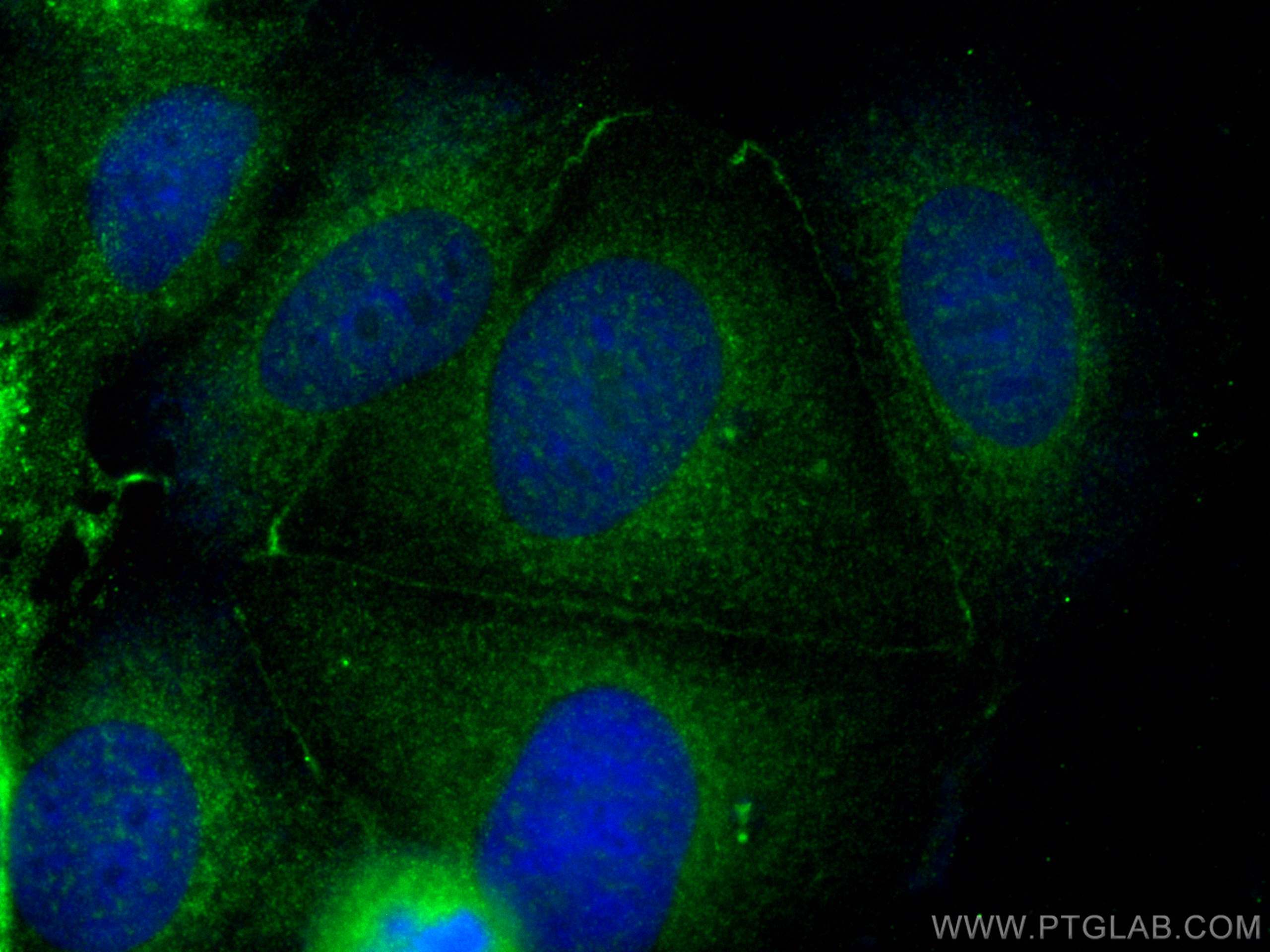 Immunofluorescence (IF) / fluorescent staining of MCF-7 cells using BCAS1 Polyclonal antibody (25776-1-AP)