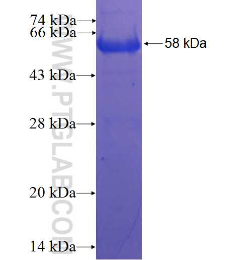 BCAS1 fusion protein Ag22811 SDS-PAGE