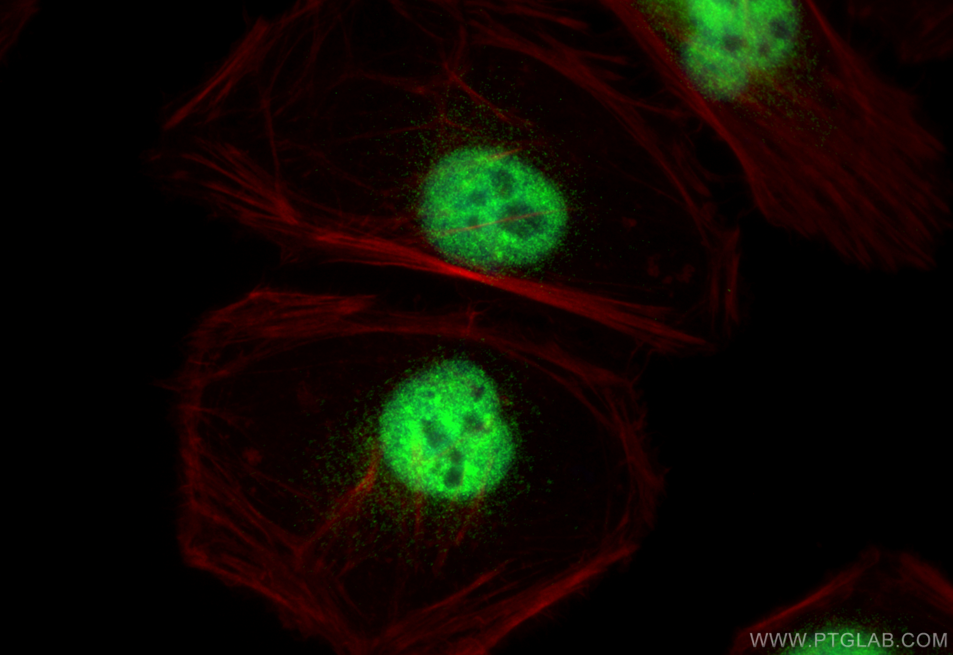 Immunofluorescence (IF) / fluorescent staining of HeLa cells using BCAS2 Polyclonal antibody (10414-1-AP)