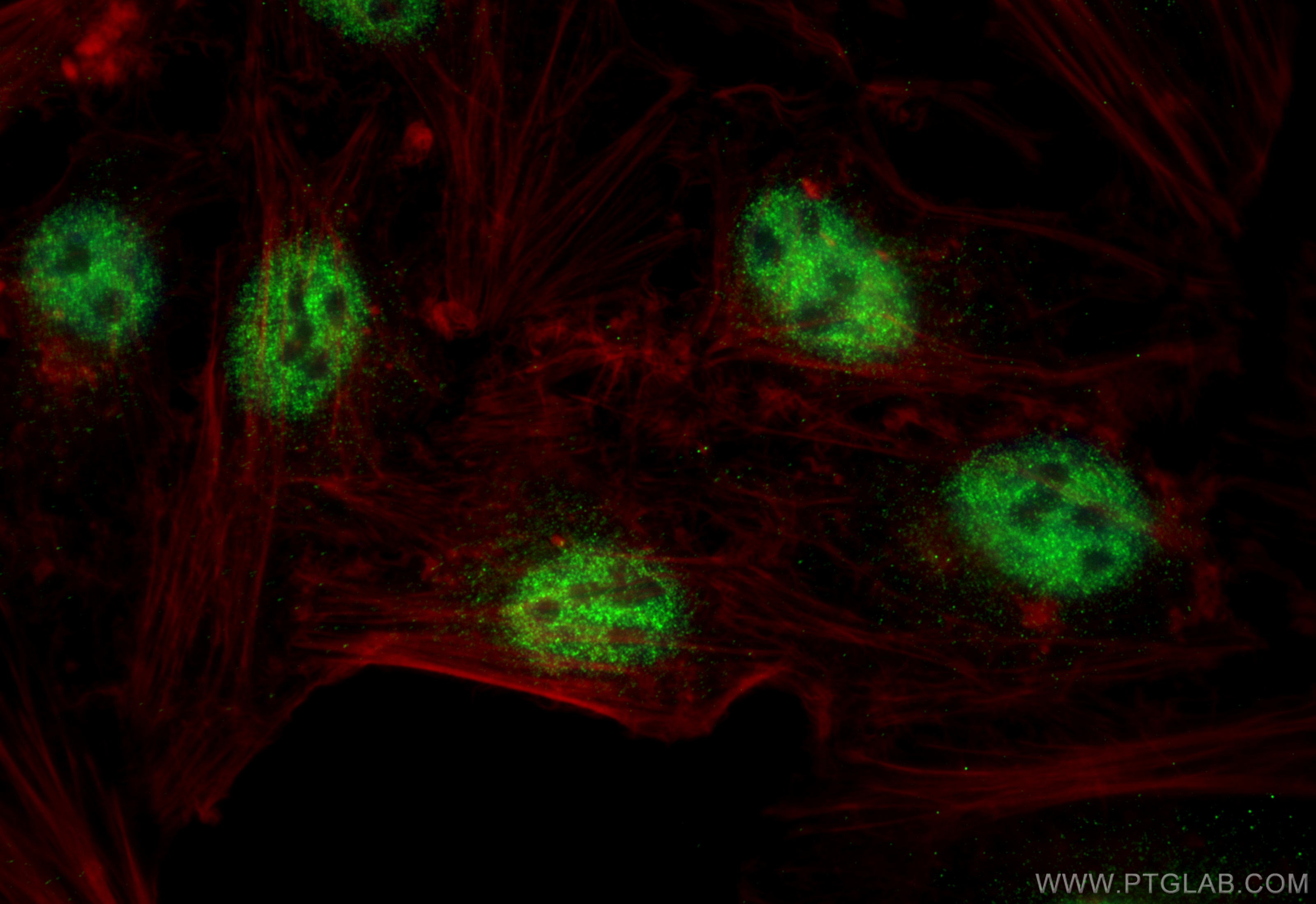 Immunofluorescence (IF) / fluorescent staining of HeLa cells using BCAS2 Monoclonal antibody (68003-1-Ig)