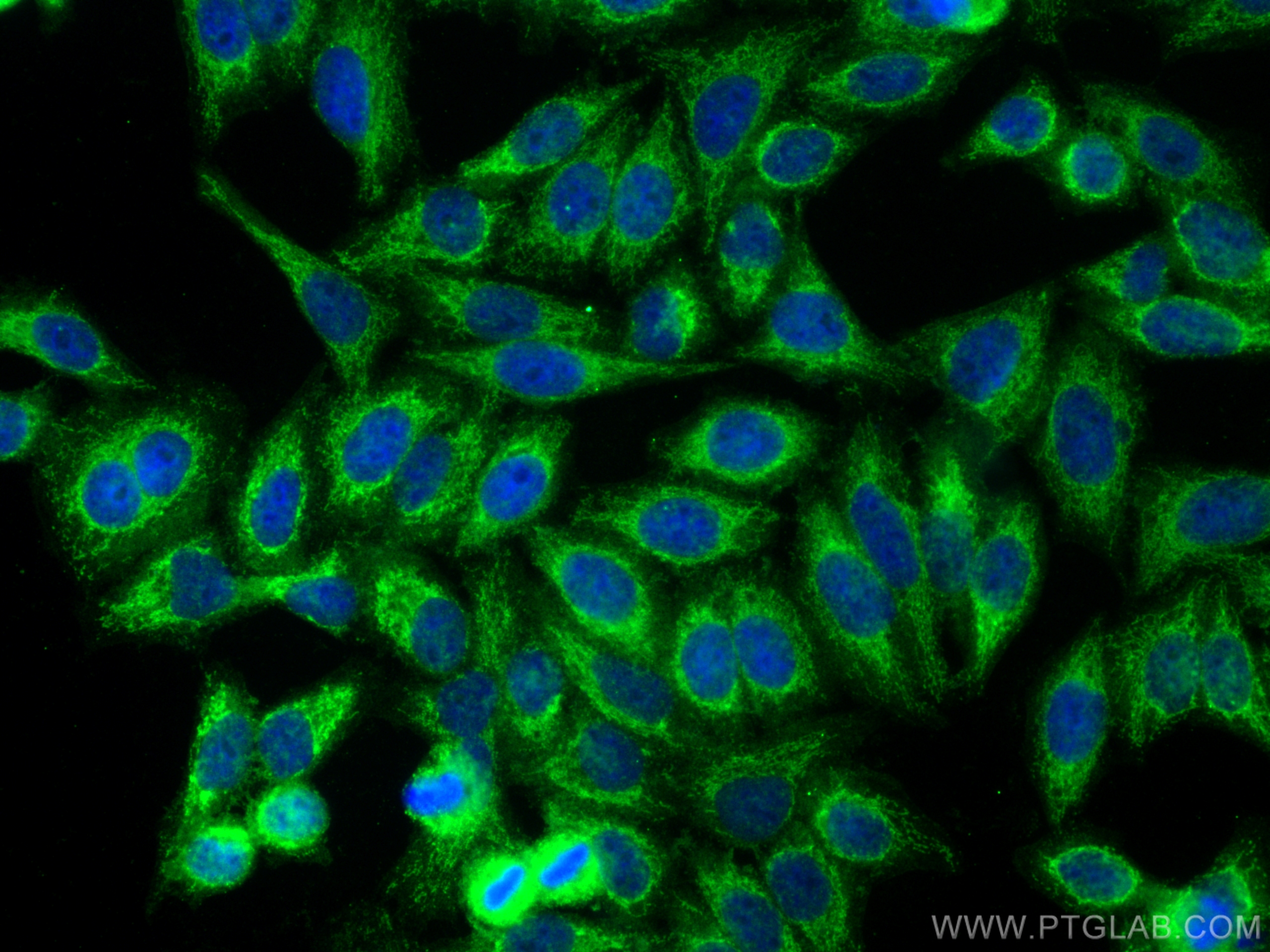 Immunofluorescence (IF) / fluorescent staining of HepG2 cells using BCAT1 Polyclonal antibody (13640-1-AP)