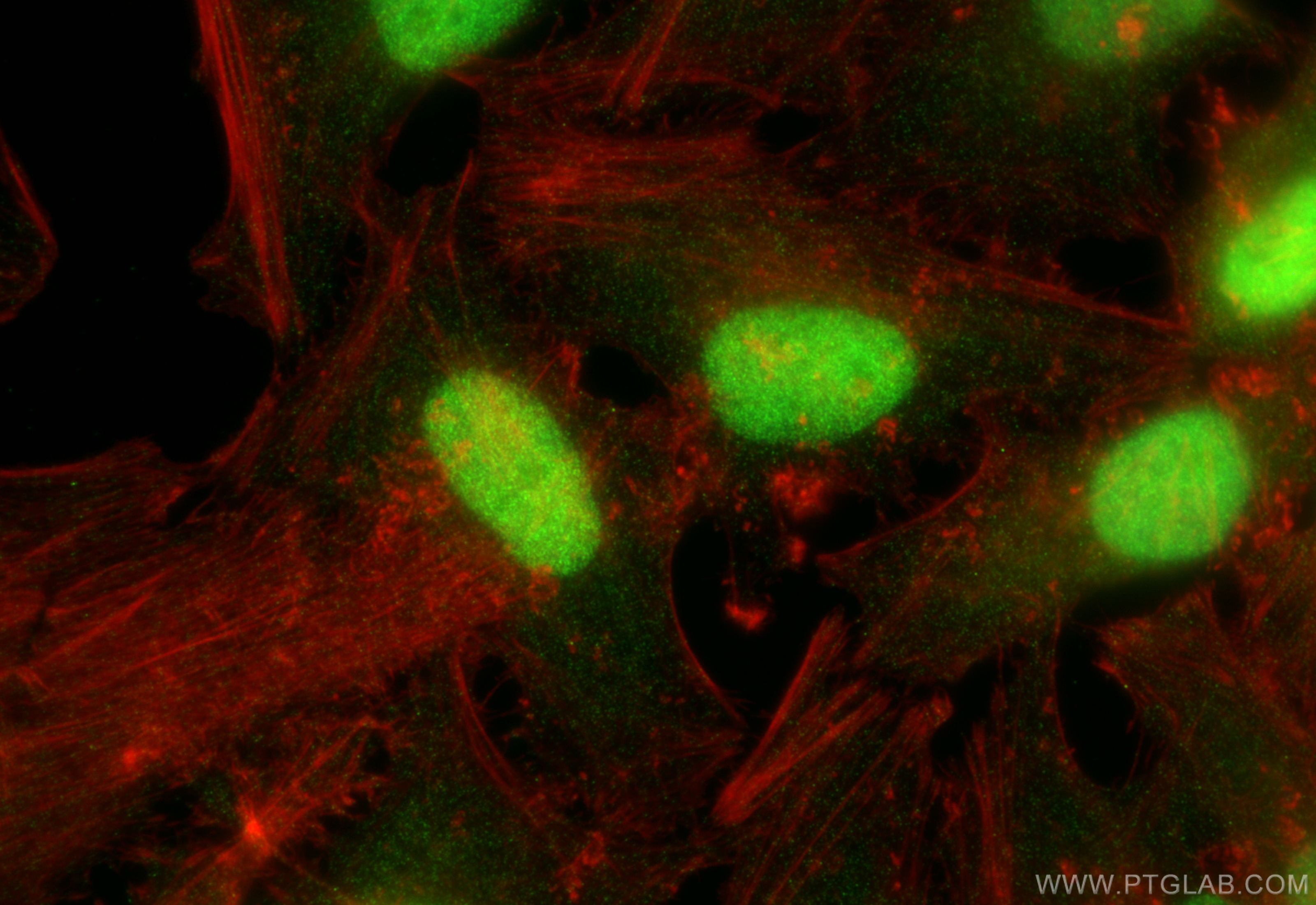 Immunofluorescence (IF) / fluorescent staining of HeLa cells using BCCIP Polyclonal antibody (16043-1-AP)