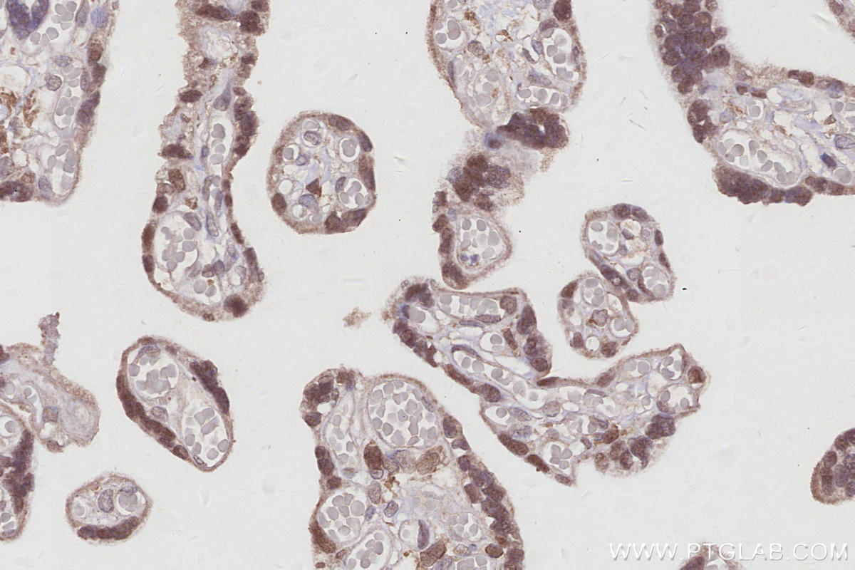 Immunohistochemistry (IHC) staining of human placenta tissue using BCCIP Polyclonal antibody (16043-1-AP)