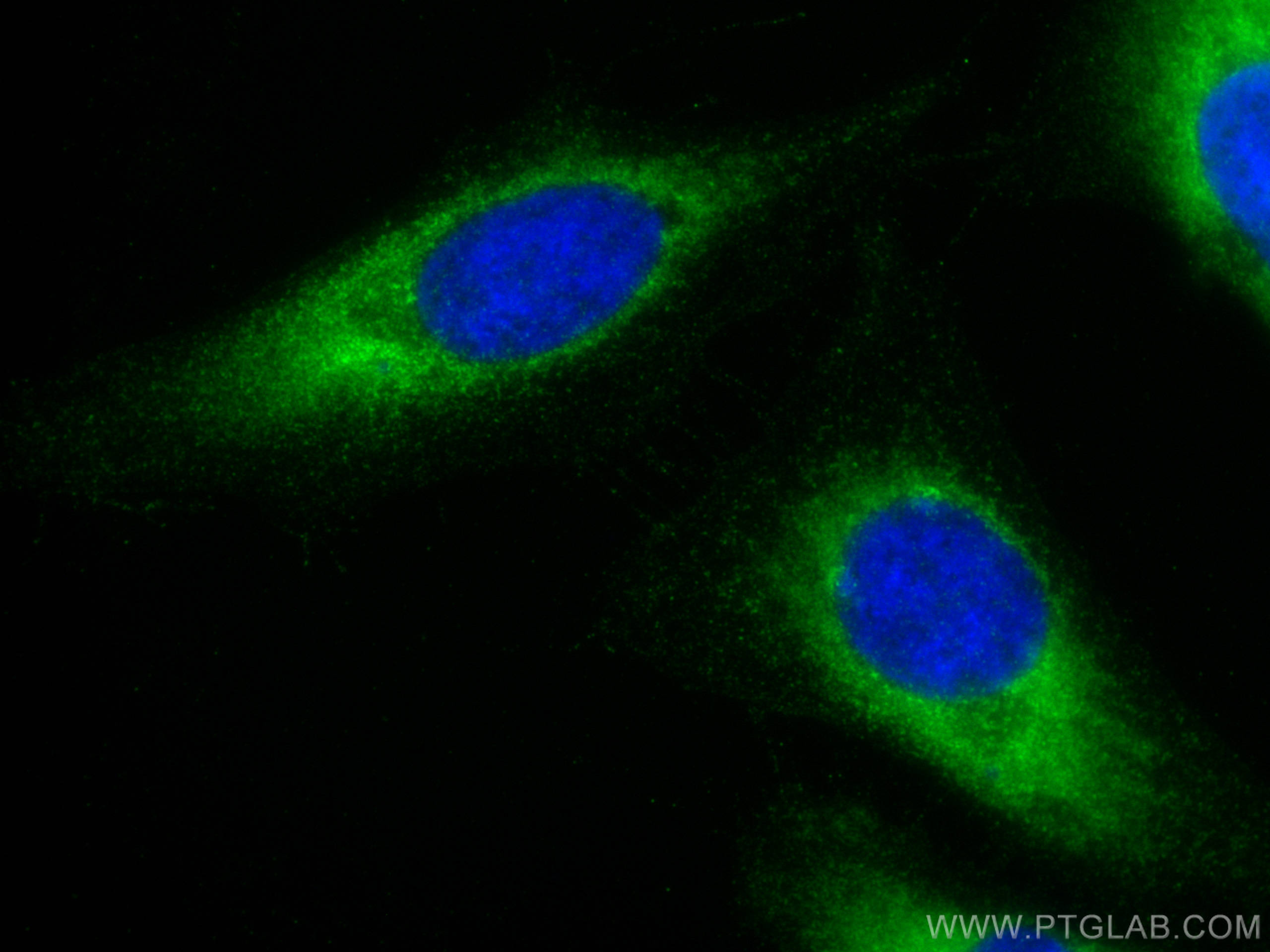 Immunofluorescence (IF) / fluorescent staining of HeLa cells using BCHE Polyclonal antibody (23854-1-AP)
