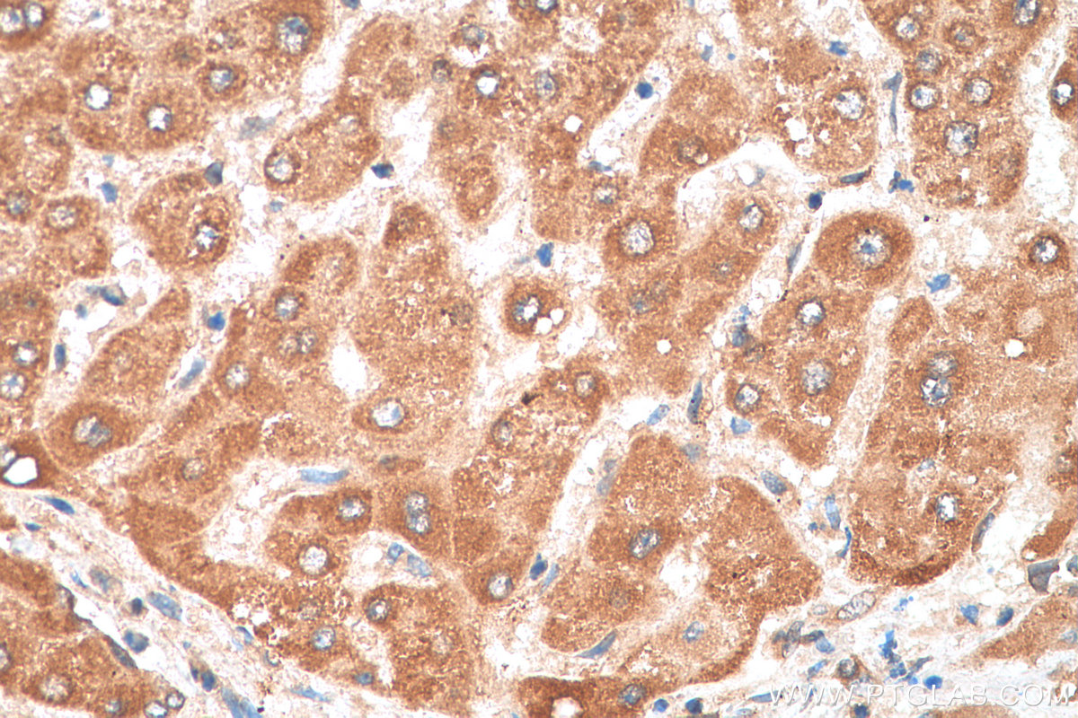 Immunohistochemistry (IHC) staining of human liver tissue using BCKDHA Polyclonal antibody (30028-1-AP)