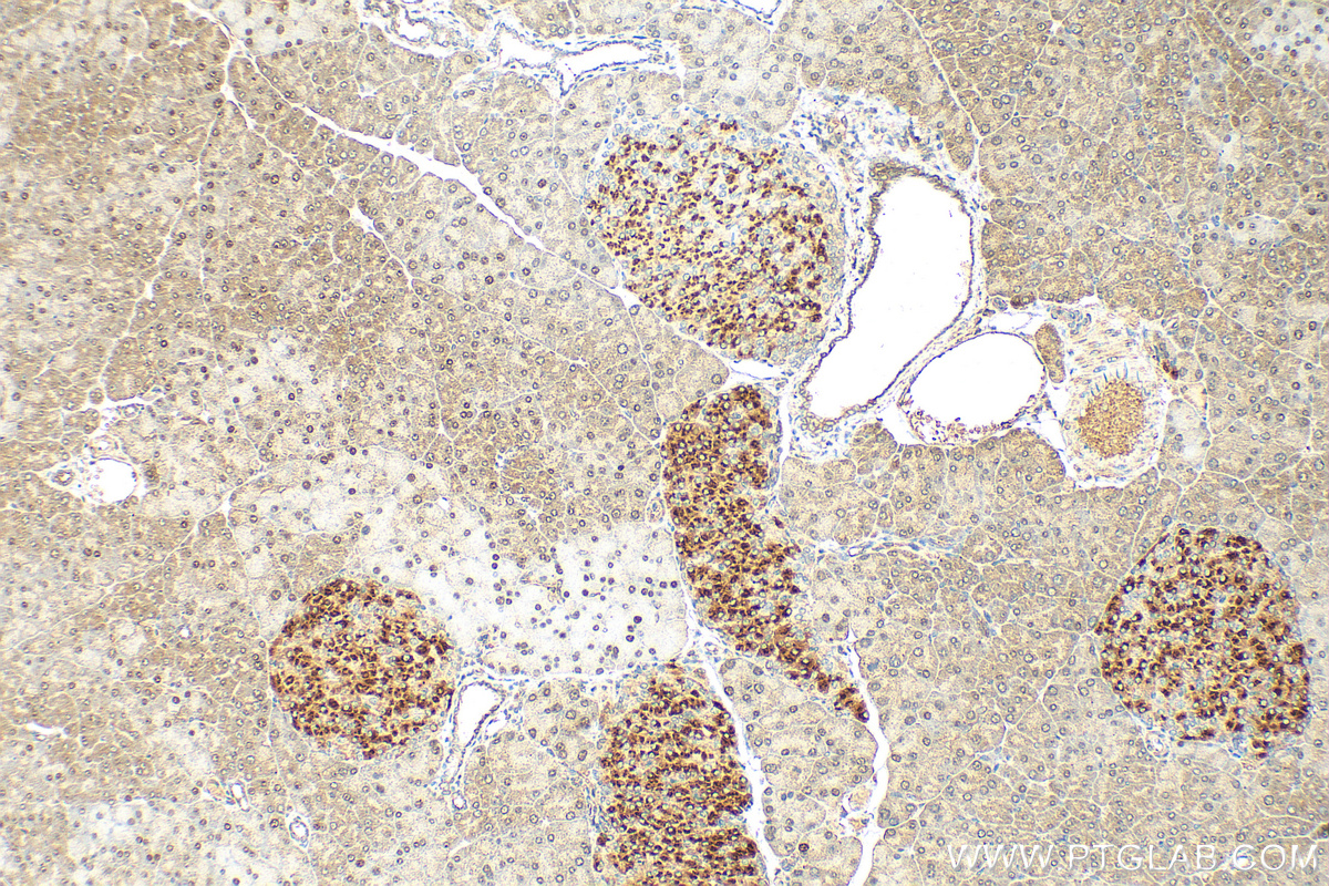 Immunohistochemistry (IHC) staining of mouse pancreas tissue using BCKDK Polyclonal antibody (15718-1-AP)