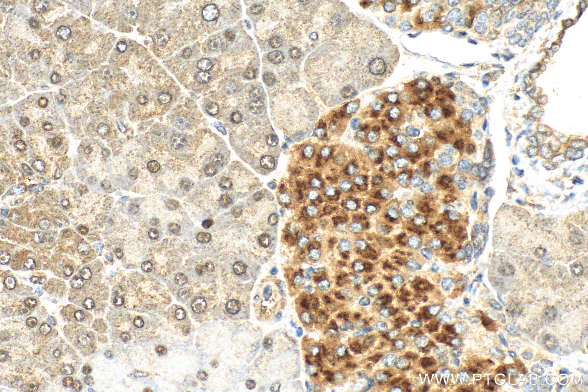 Immunohistochemistry (IHC) staining of mouse pancreas tissue using BCKDK Polyclonal antibody (15718-1-AP)