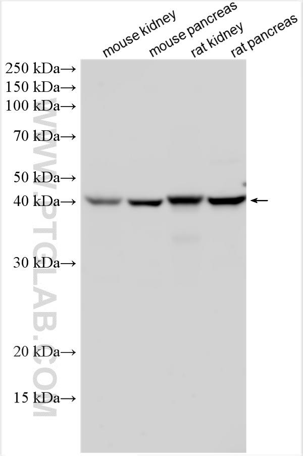 Western Blot (WB) analysis of various lysates using BCKDK Polyclonal antibody (15718-1-AP)