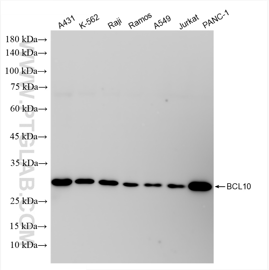 Western Blot (WB) analysis of various lysates using BCL10 Recombinant antibody (85858-2-RR)