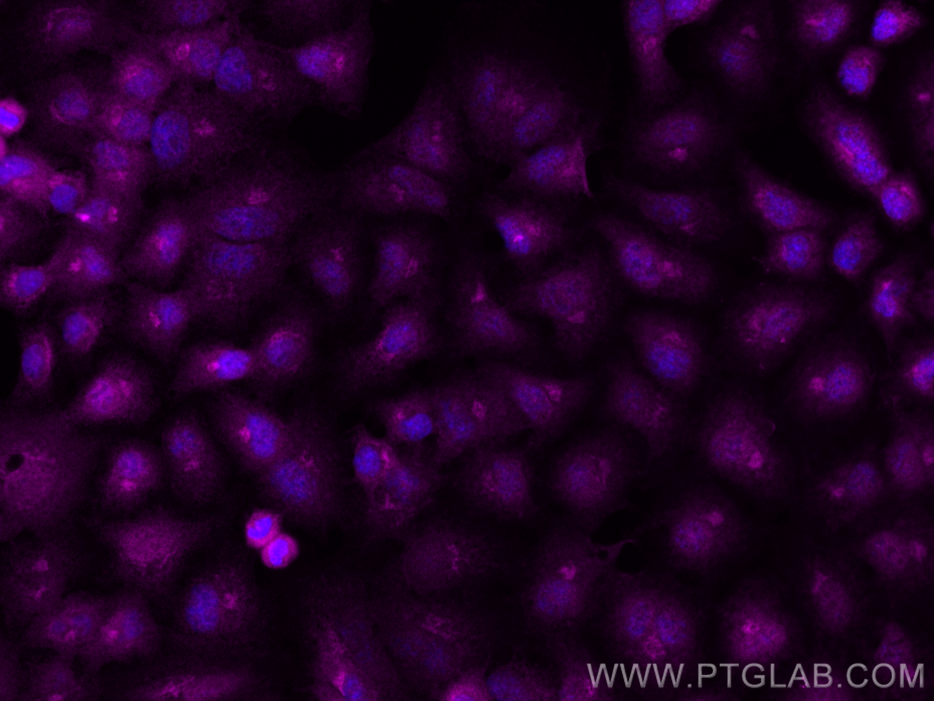 Immunofluorescence (IF) / fluorescent staining of A549 cells using CoraLite® Plus 647-conjugated BCL10 Polyclonal ant (CL647-50180)