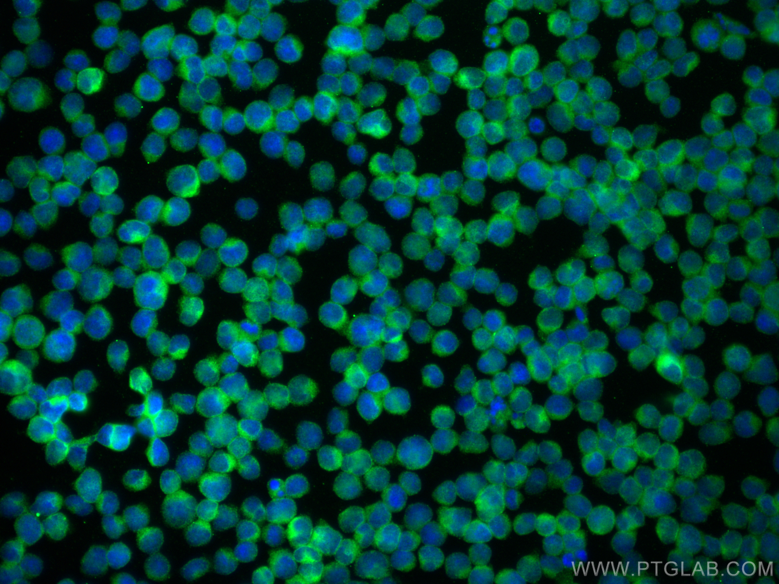 Immunofluorescence (IF) / fluorescent staining of Jurkat cells using human BCL2 Polyclonal antibody (12789-1-AP)