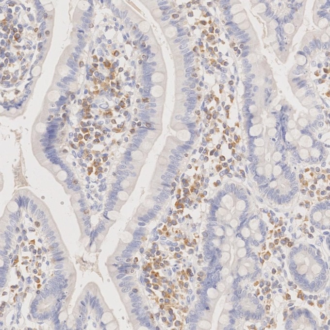 Immunohistochemistry (IHC) staining of human small intestine tissue using BCL2 Monoclonal antibody (60178-1-Ig)