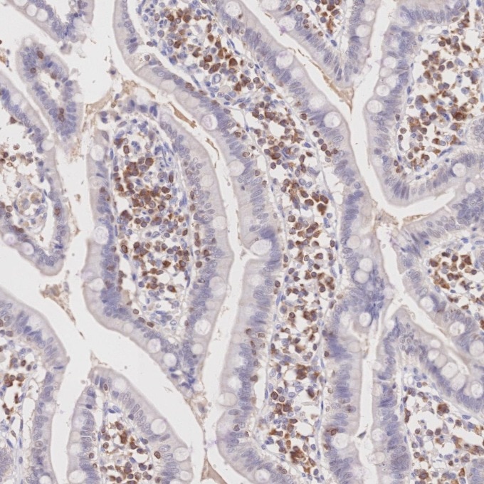 Immunohistochemistry (IHC) staining of human small intestine tissue using BCL2 Monoclonal antibody (60178-1-Ig)