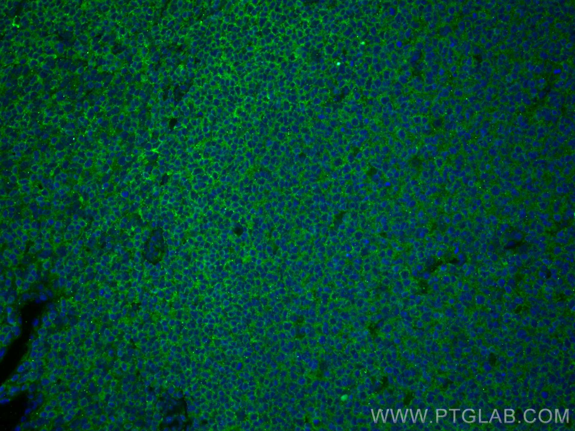 Immunofluorescence (IF) / fluorescent staining of human tonsillitis tissue using BCL2 Recombinant antibody (80313-1-RR)