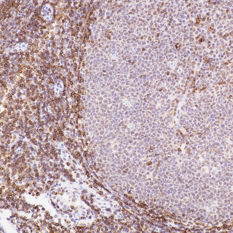 Immunohistochemistry (IHC) staining of Human Tonsil using BCL2 Recombinant monoclonal antibody (80313-1-RR)