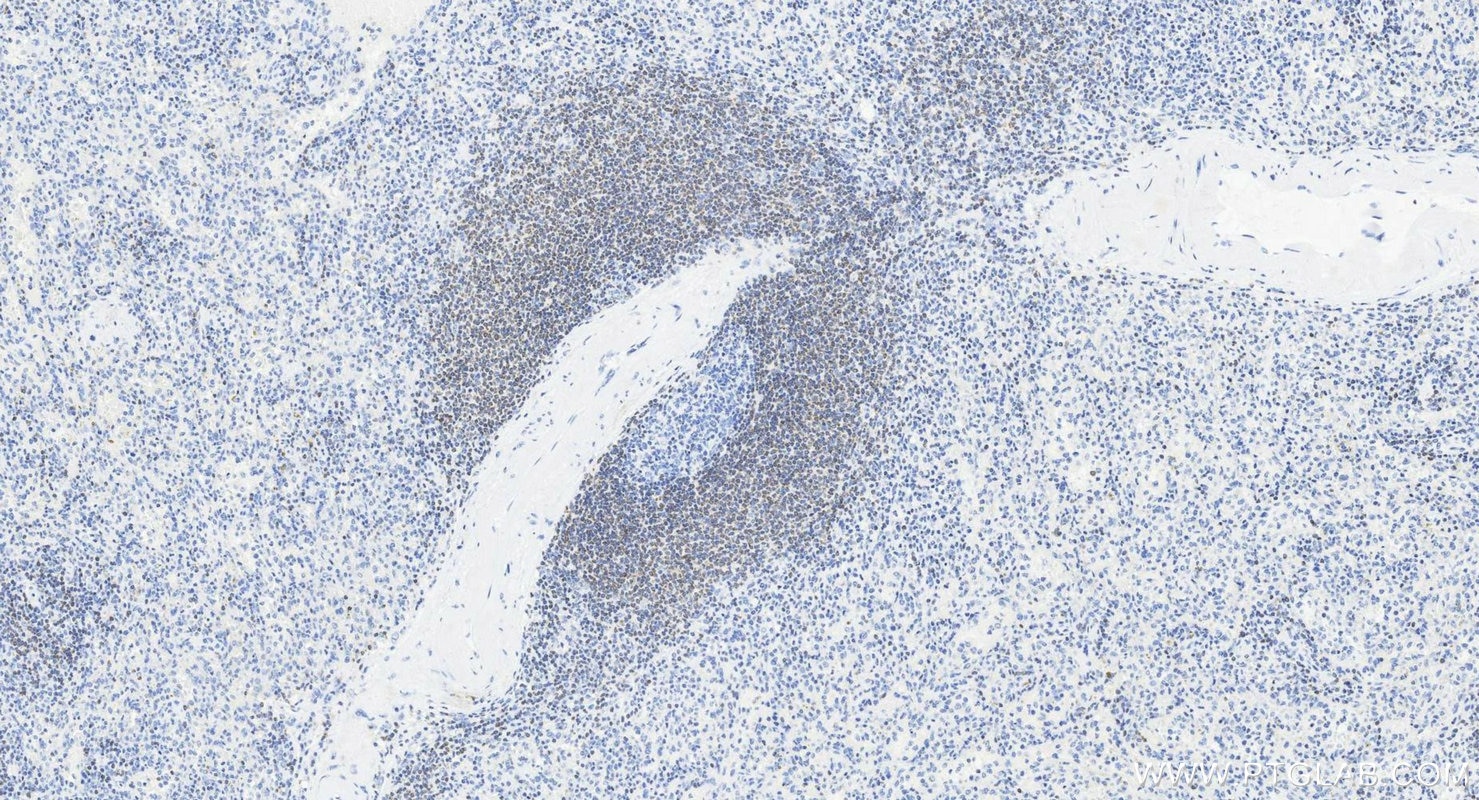 Immunohistochemistry (IHC) staining of human spleen tissue using BCL2 Recombinant monoclonal antibody (80313-1-RR)