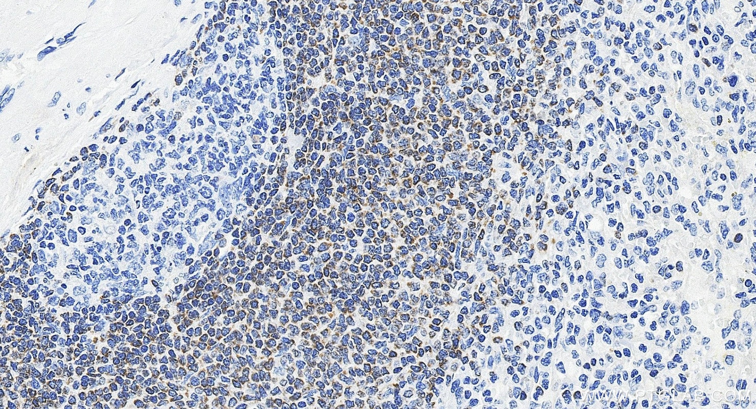Immunohistochemistry (IHC) staining of human spleen tissue using BCL2 Recombinant monoclonal antibody (80313-1-RR)