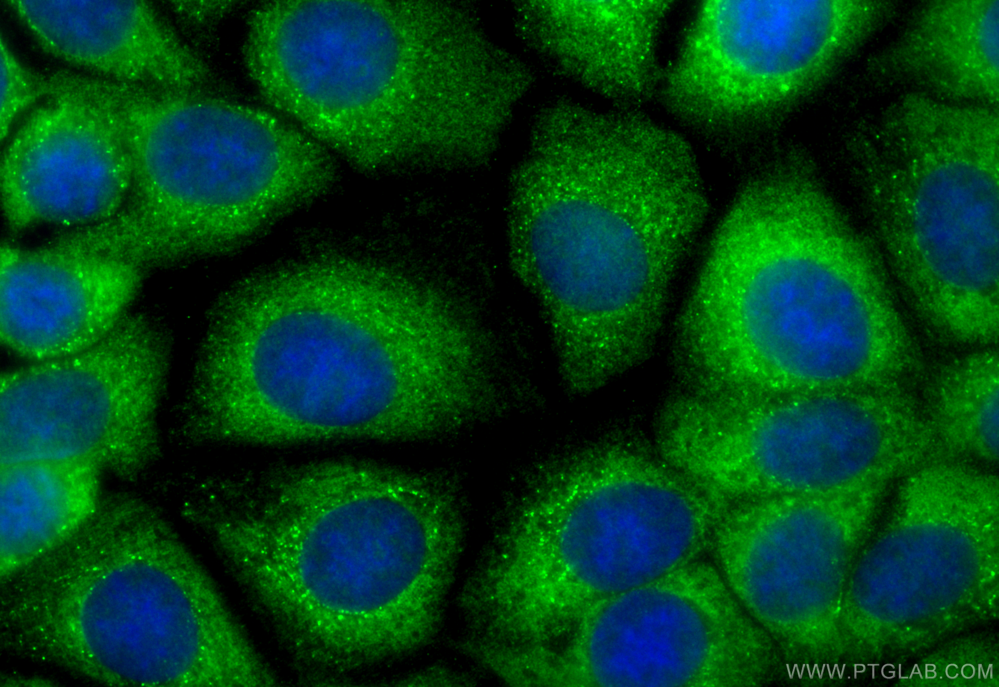 Immunofluorescence (IF) / fluorescent staining of MCF-7 cells using CoraLite® Plus 488-conjugated BCL2 Recombinant ant (CL488-80313)
