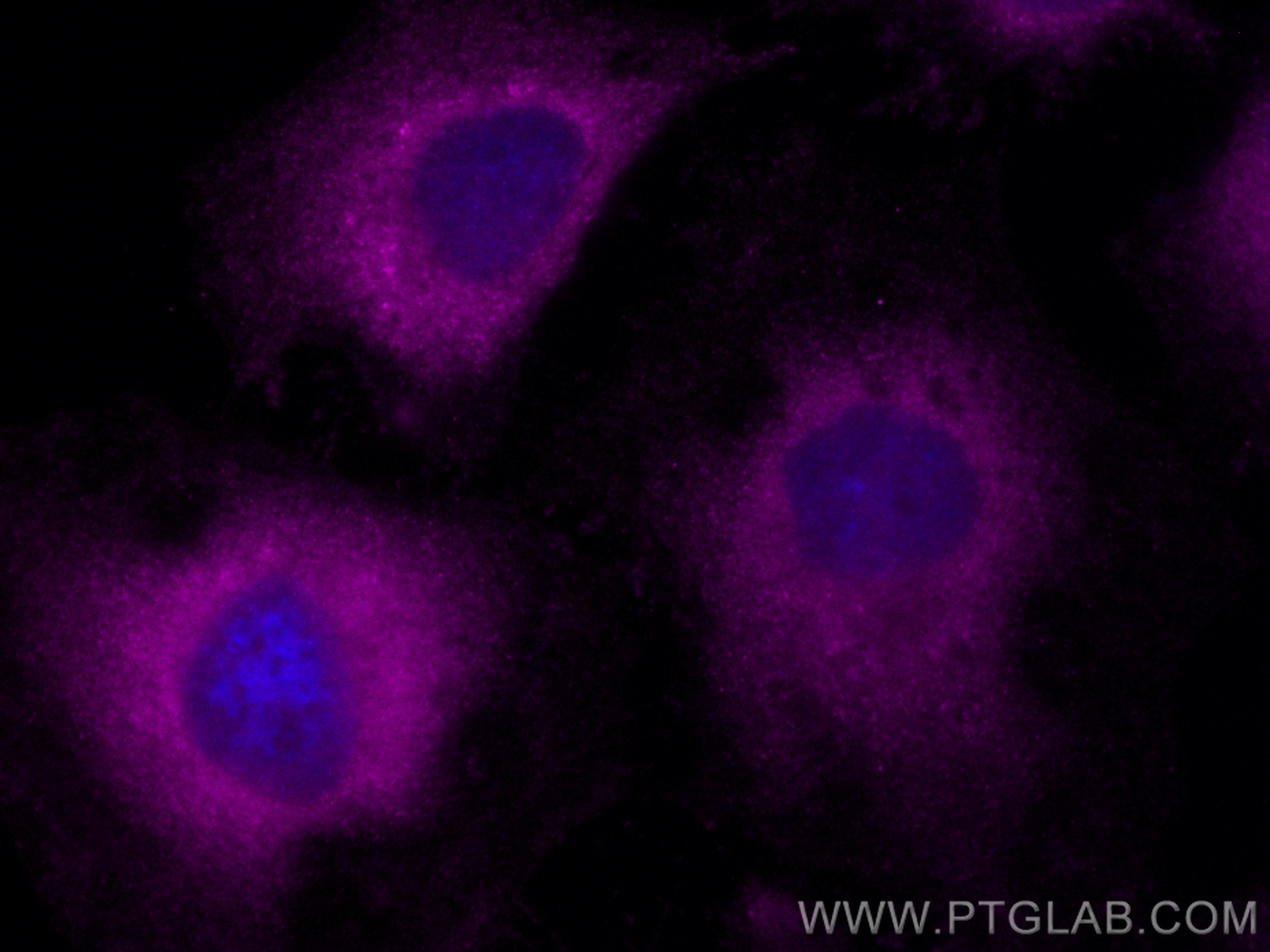 Immunofluorescence (IF) / fluorescent staining of HeLa cells using CoraLite® Plus 647-conjugated BCL2 Monoclonal anti (CL647-60178)