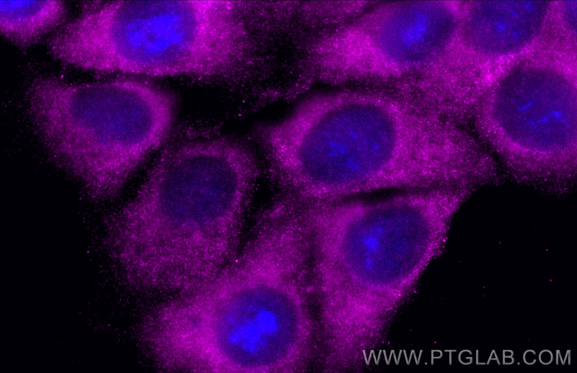 Immunofluorescence (IF) / fluorescent staining of MCF-7 cells using CoraLite® Plus 647-conjugated BCL2 Monoclonal anti (CL647-60178)