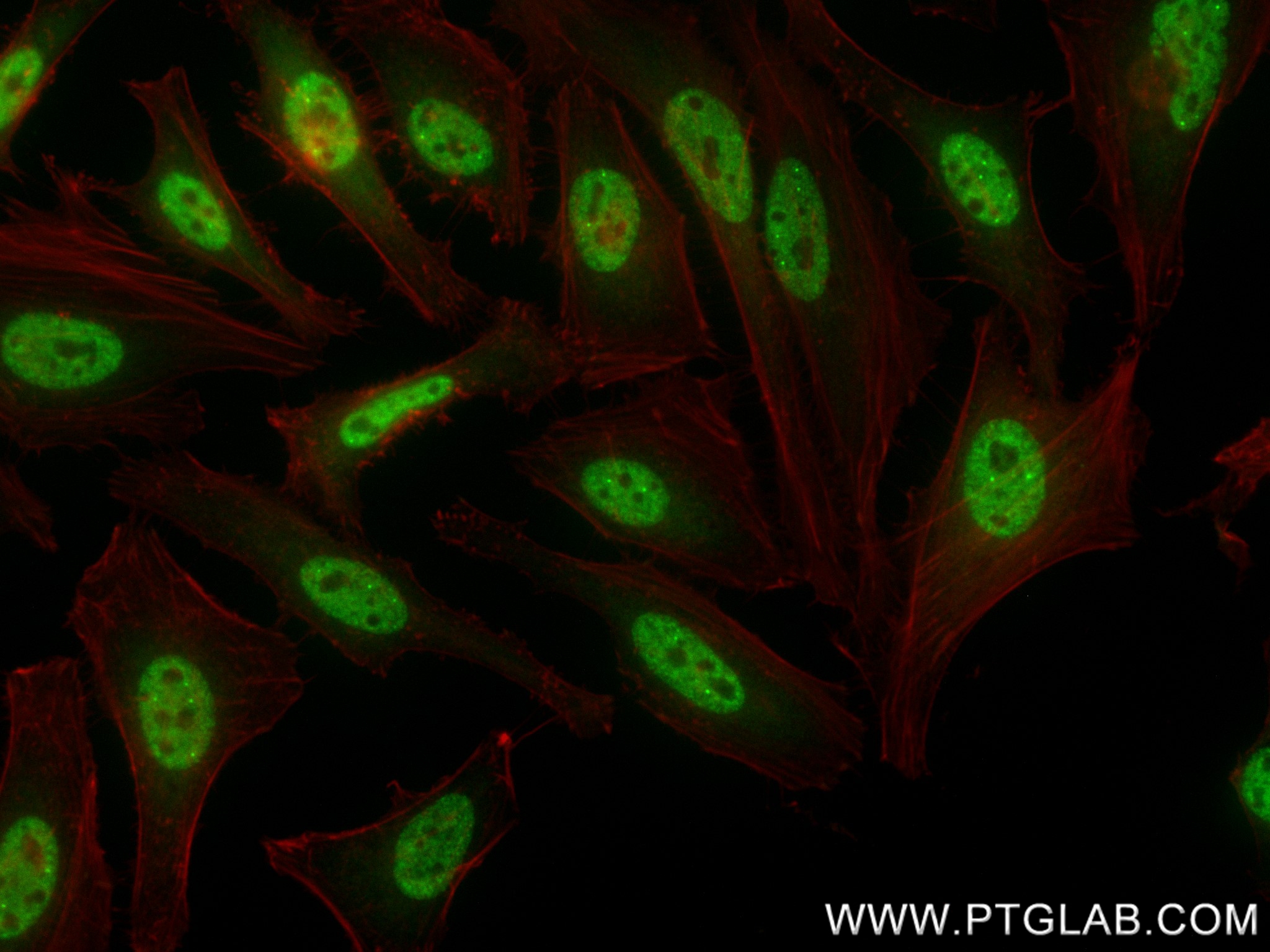 Immunofluorescence (IF) / fluorescent staining of HeLa cells using BCL3 Recombinant antibody (84882-5-RR)