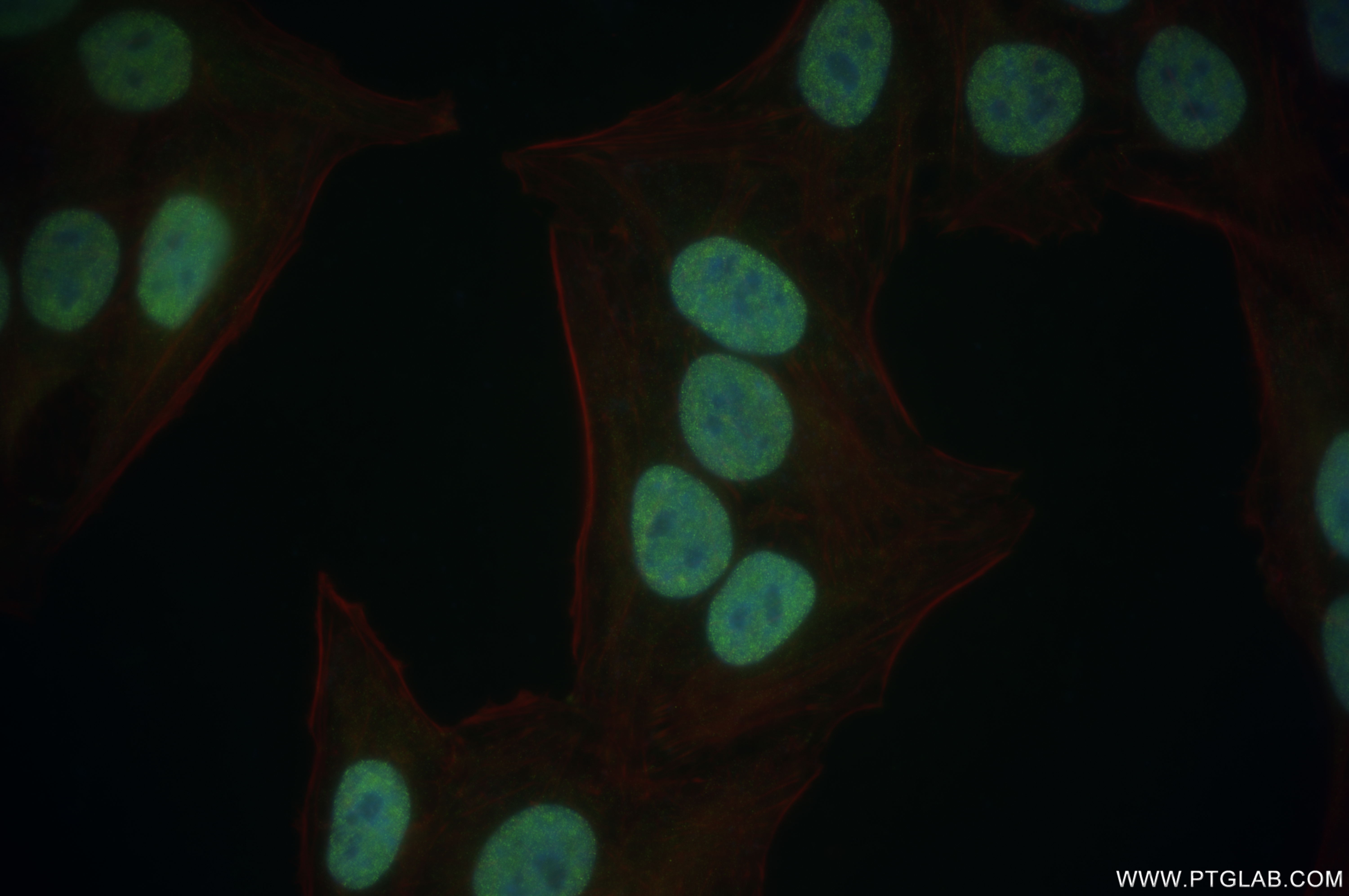 Immunofluorescence (IF) / fluorescent staining of HepG2 cells using BCL3 Recombinant antibody (84882-5-RR)